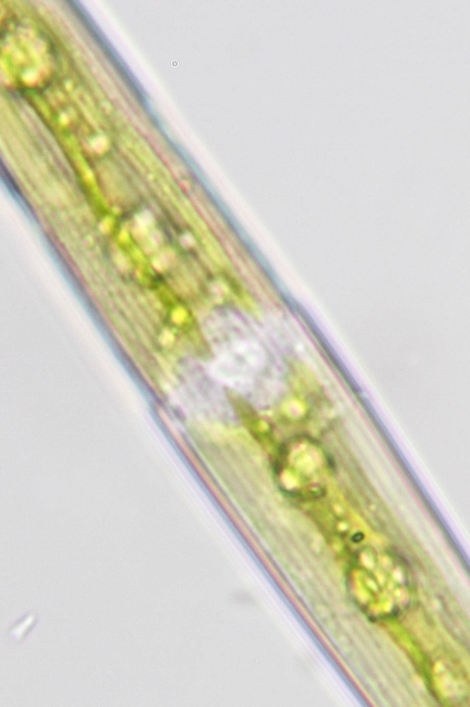 Closterium kuetzingii